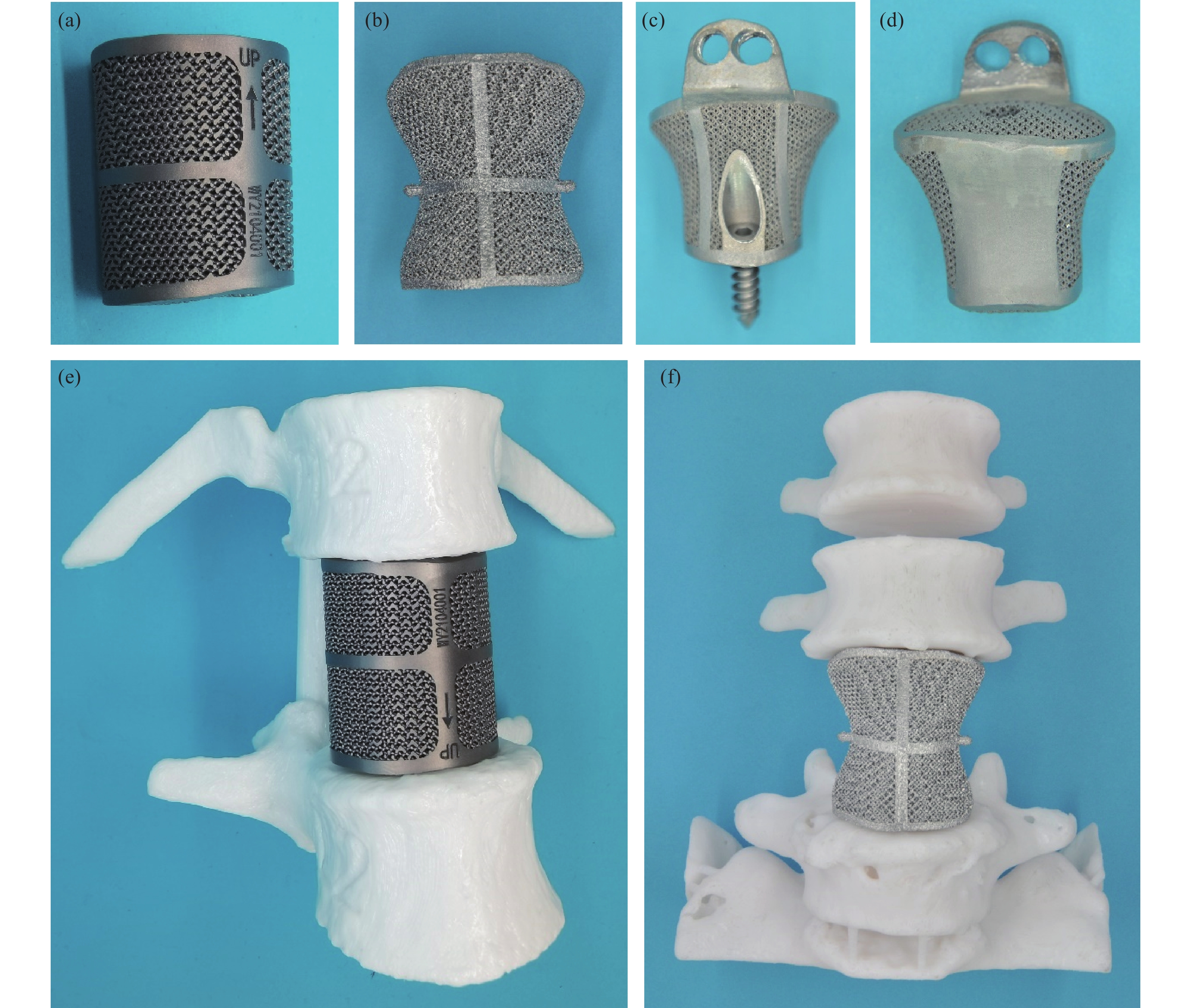 3D打印腰椎假体（钛合金材质）：（a） L4腰椎初始款；（b）L4腰椎改进