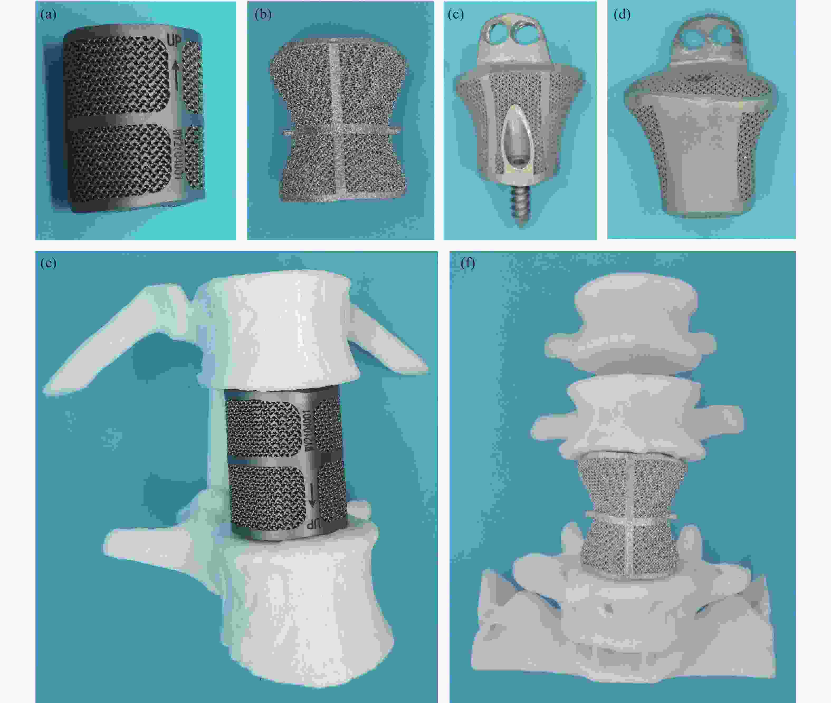 3D打印数字化定制丨PEEK下巴假体改善骨性缺失 - 知乎
