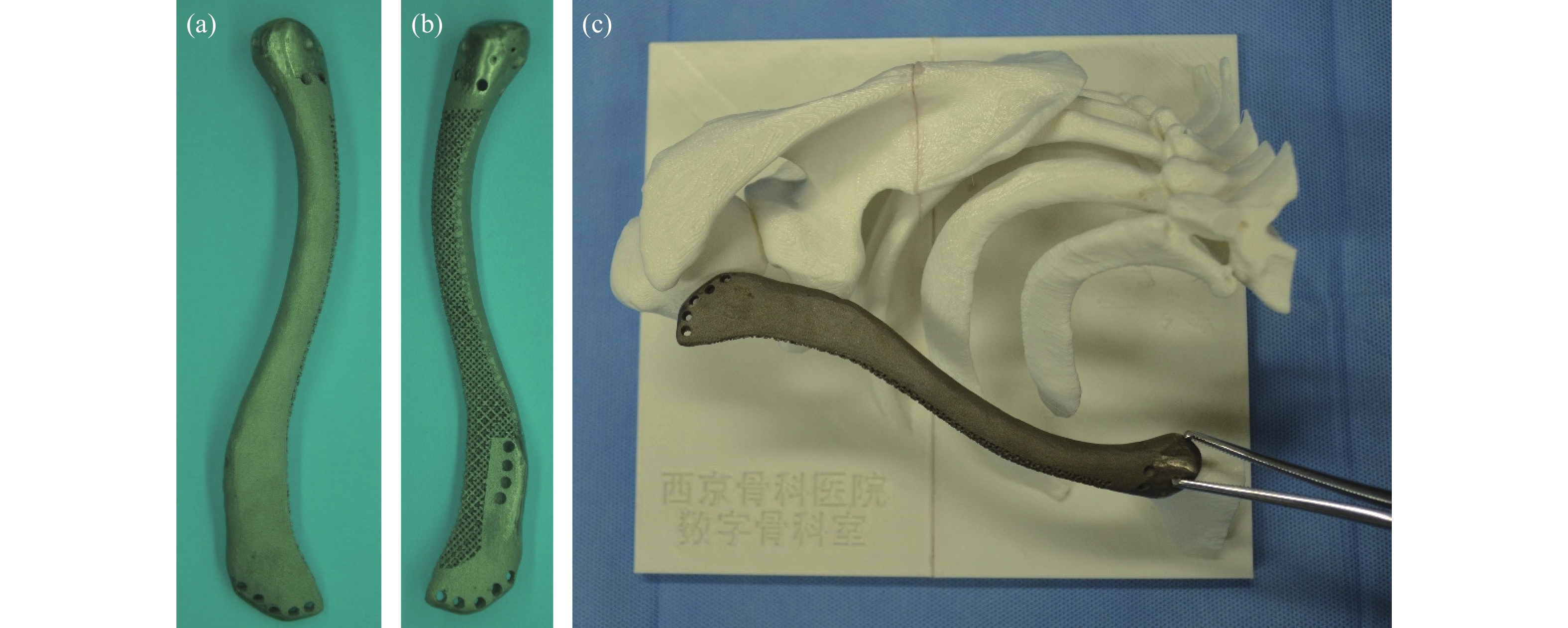 3D打印腰椎假体（钛合金材质）：（a） L4腰椎初始款；（b）L4腰椎改进